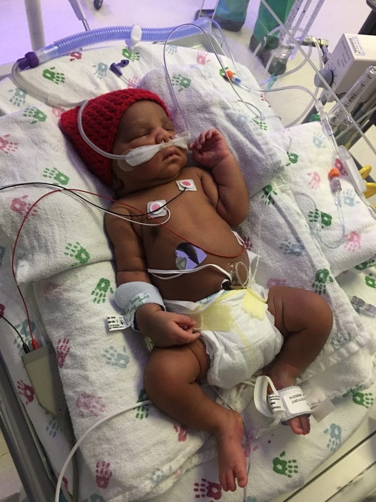 Premature baby in the NICU Premature baby in the NICU