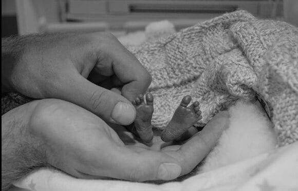 Hand cradling tiny feet of premature infant